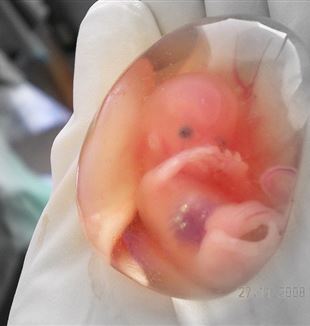 A human fetus at ten weeks gestation. Via Wikimedia Commons